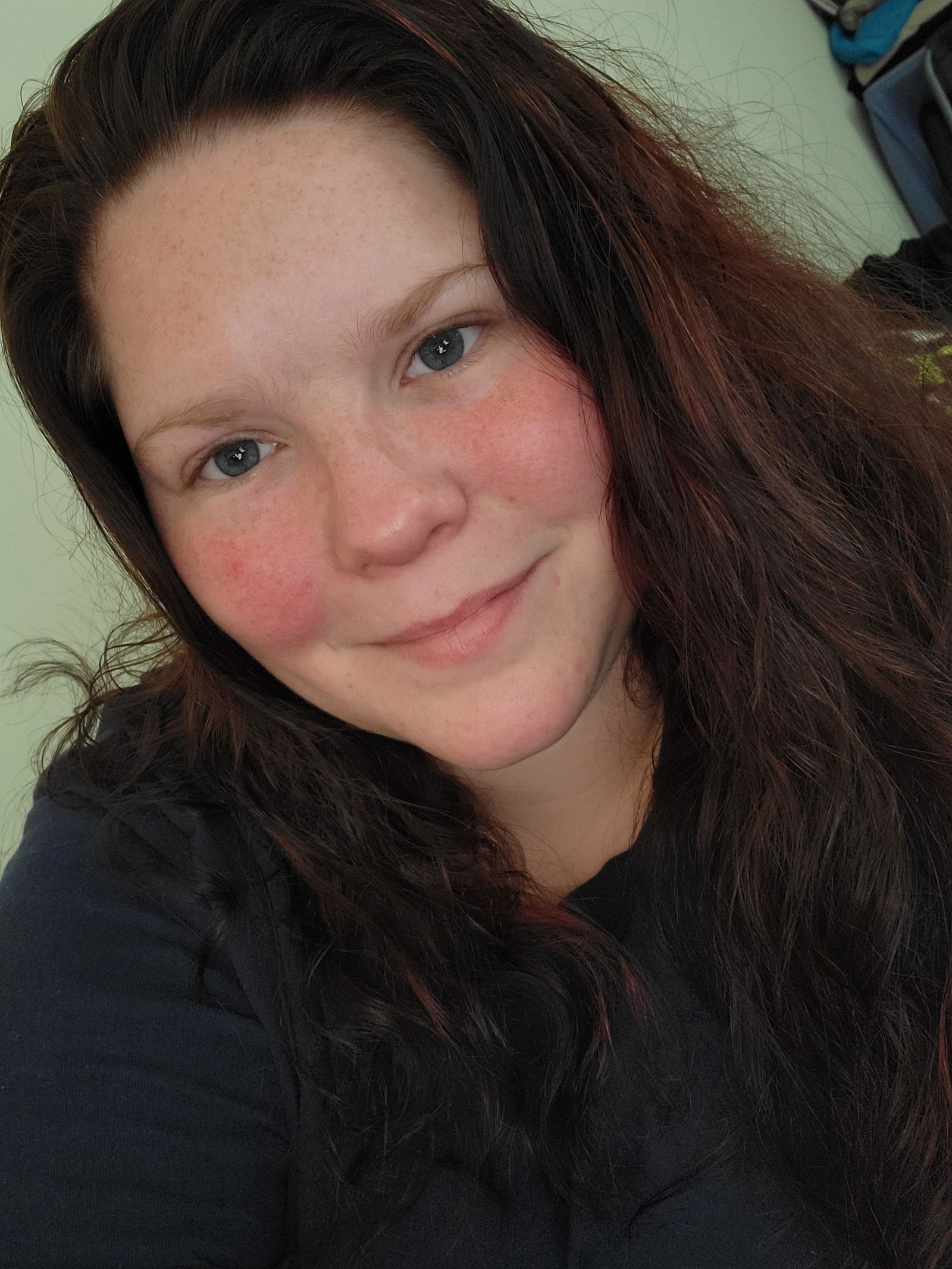 BeautifullyScarred