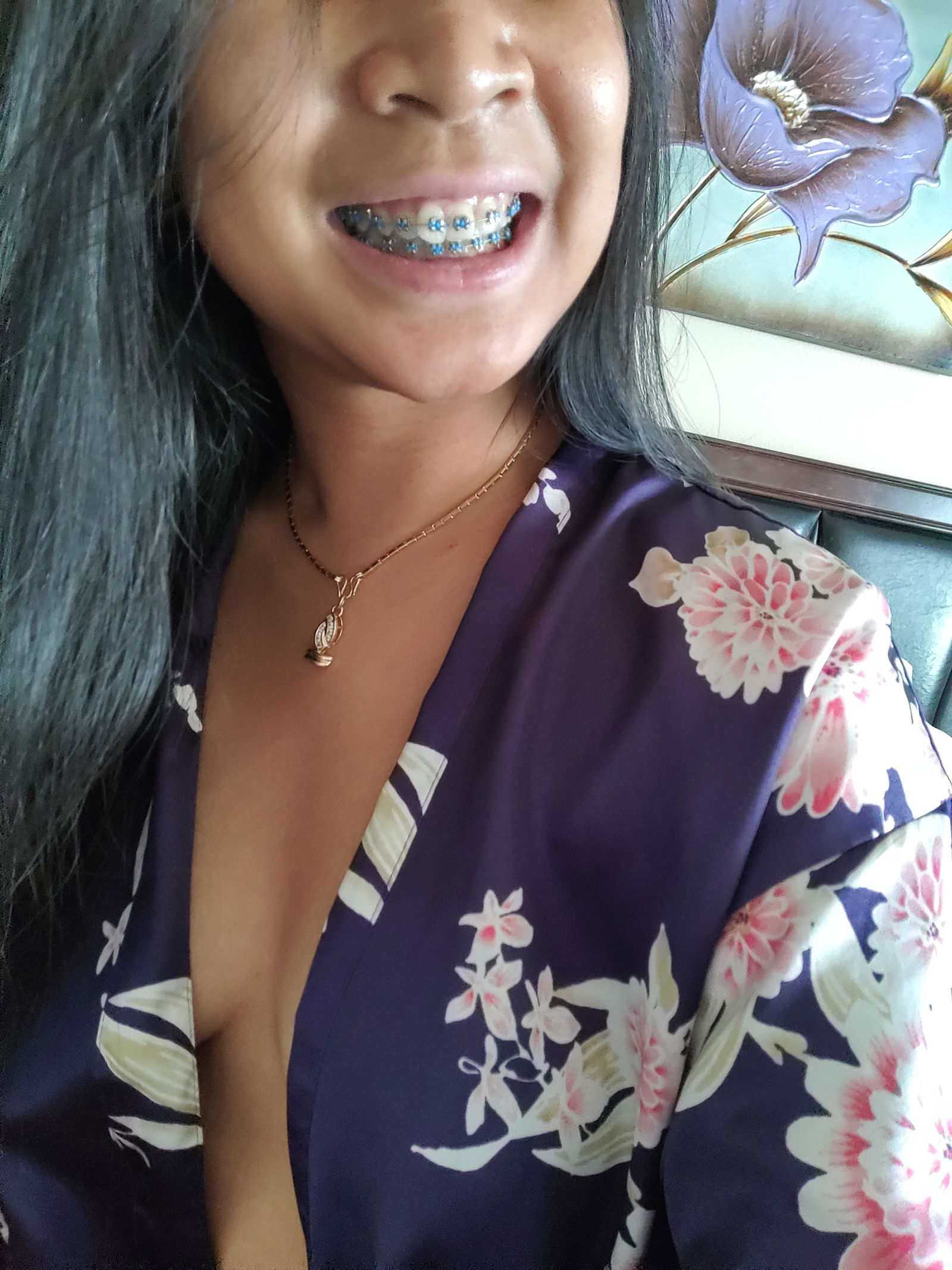 BlossomBraces's avatar