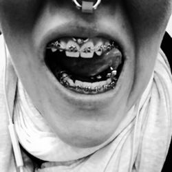 Teethshow