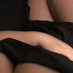 curvesnscars