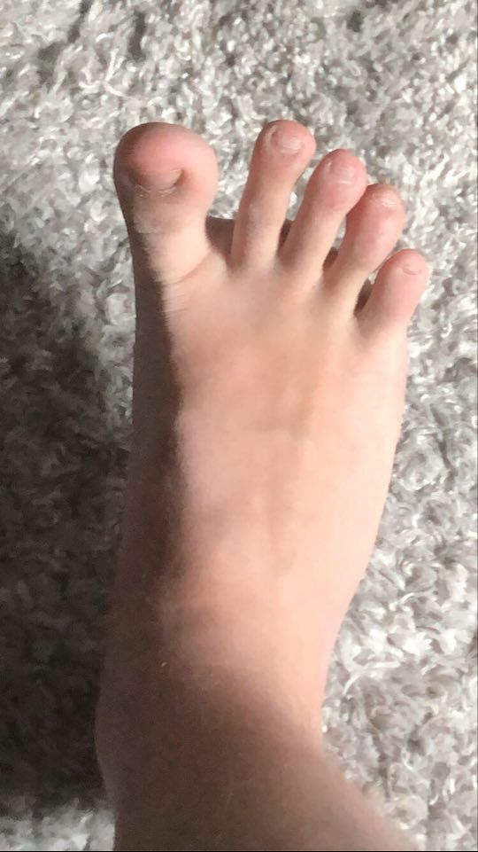 Feet for the people
