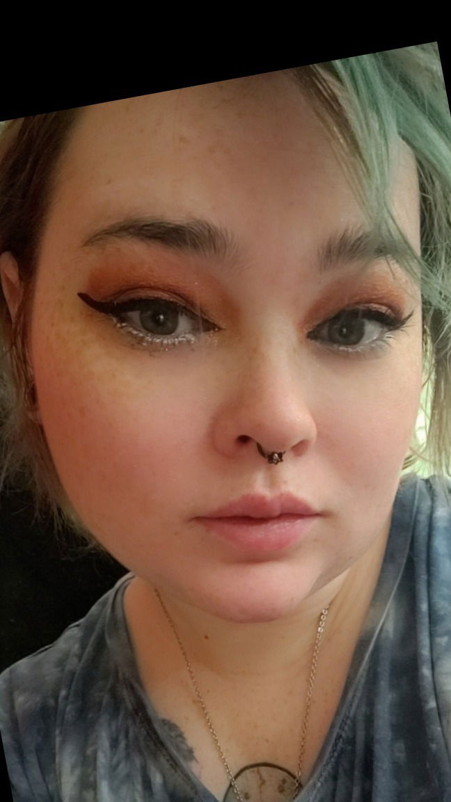 Freckles