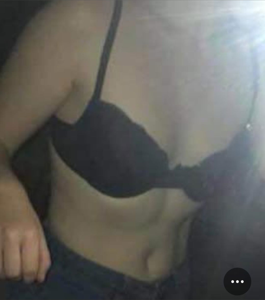 Cherry cheeks