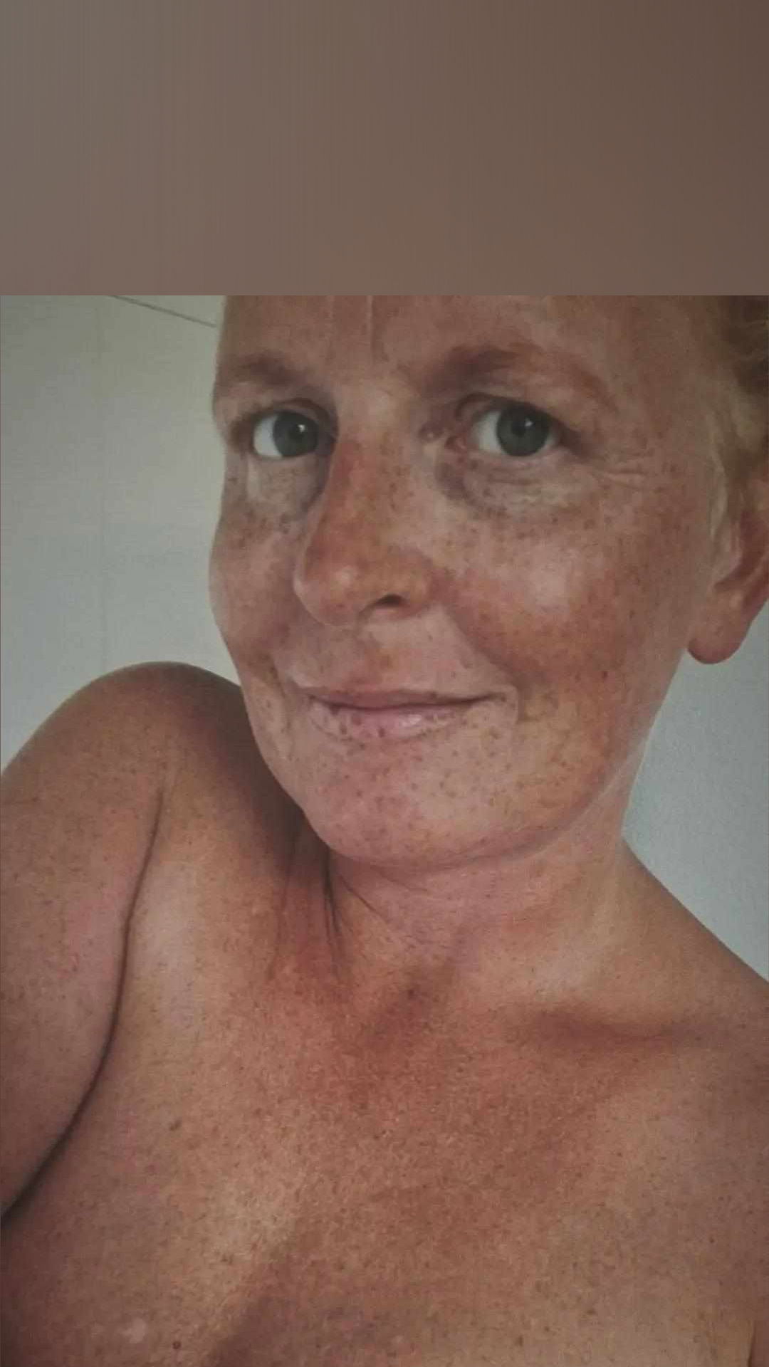 naddel