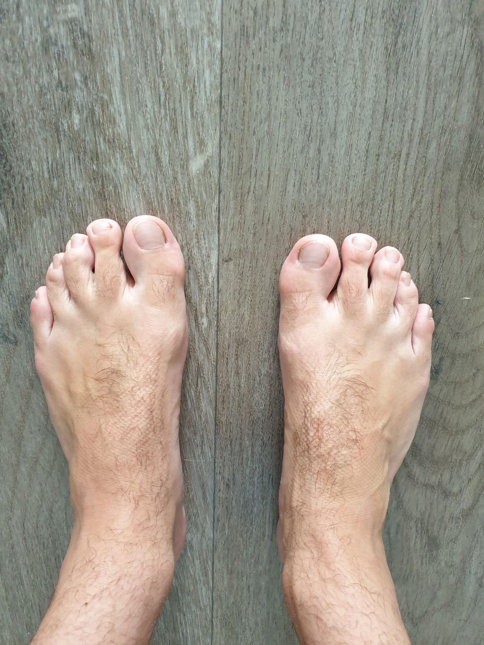 Hairy feet