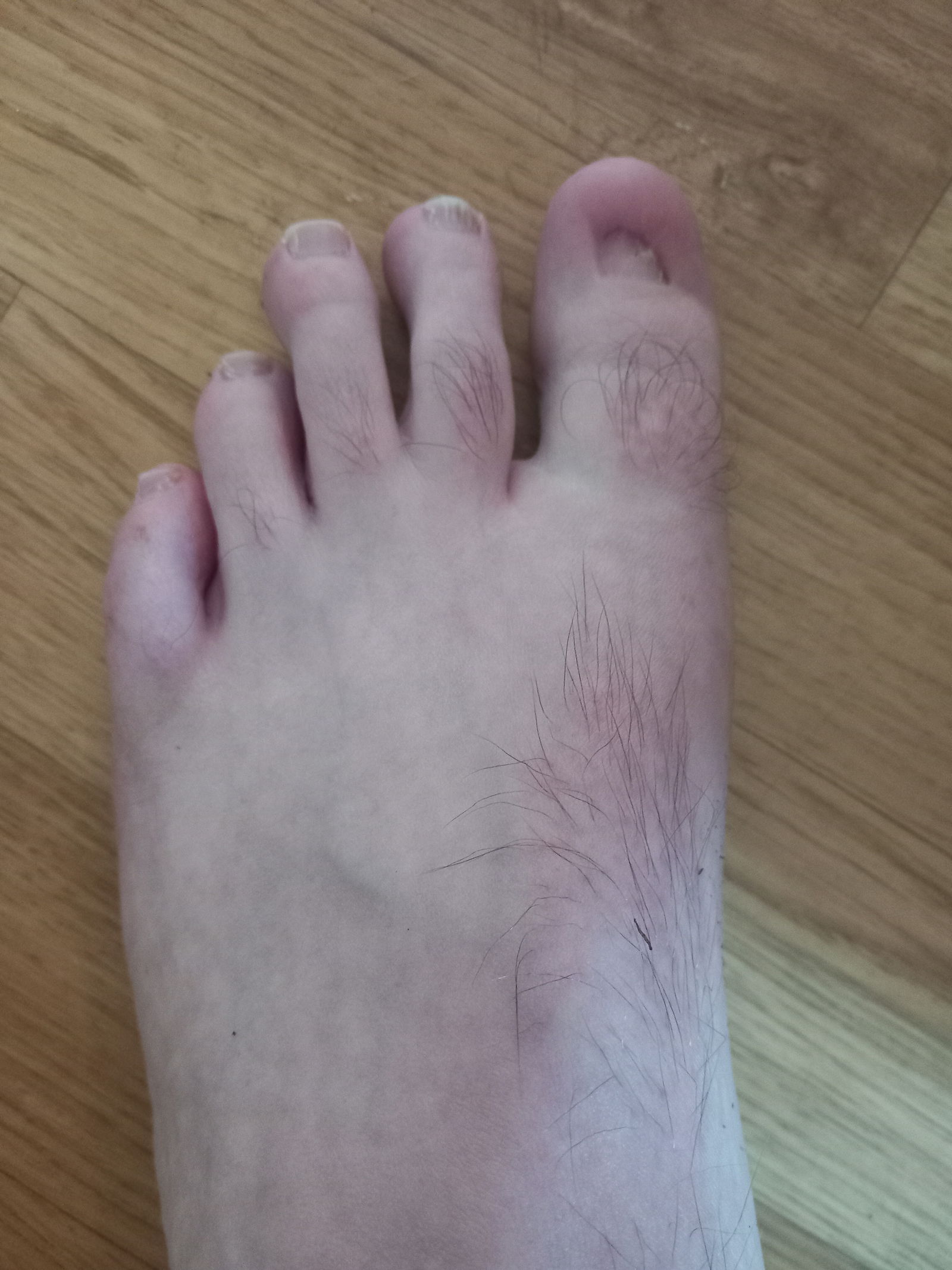 Jimmy Feet's avatar