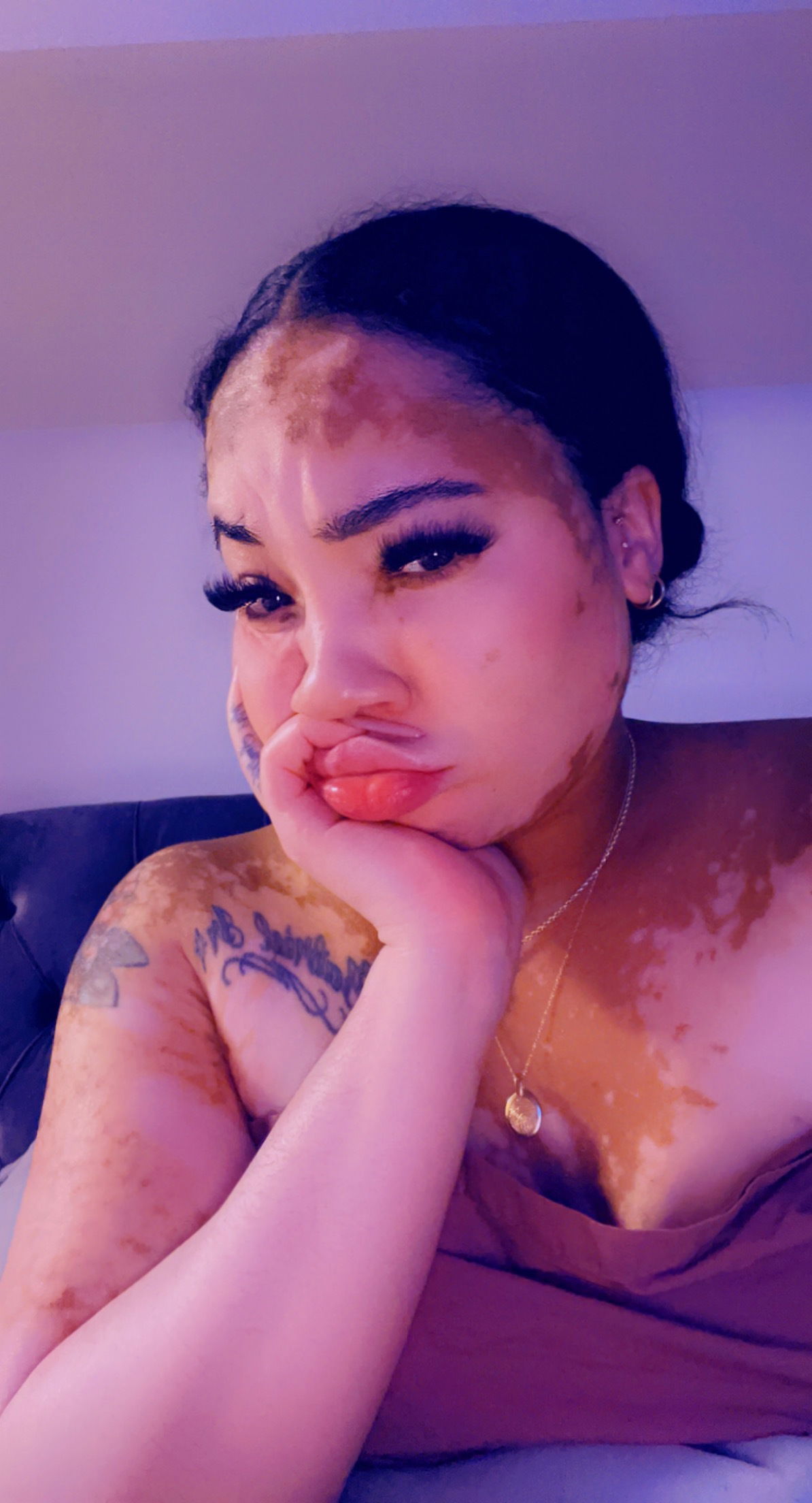 Vitiligo Bae's avatar
