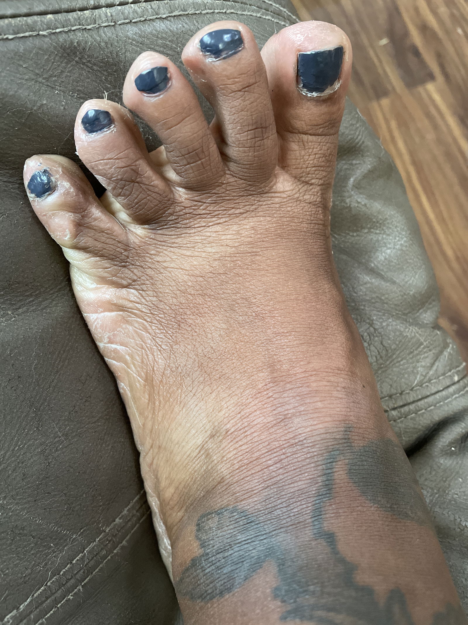 Ugly feet's avatar