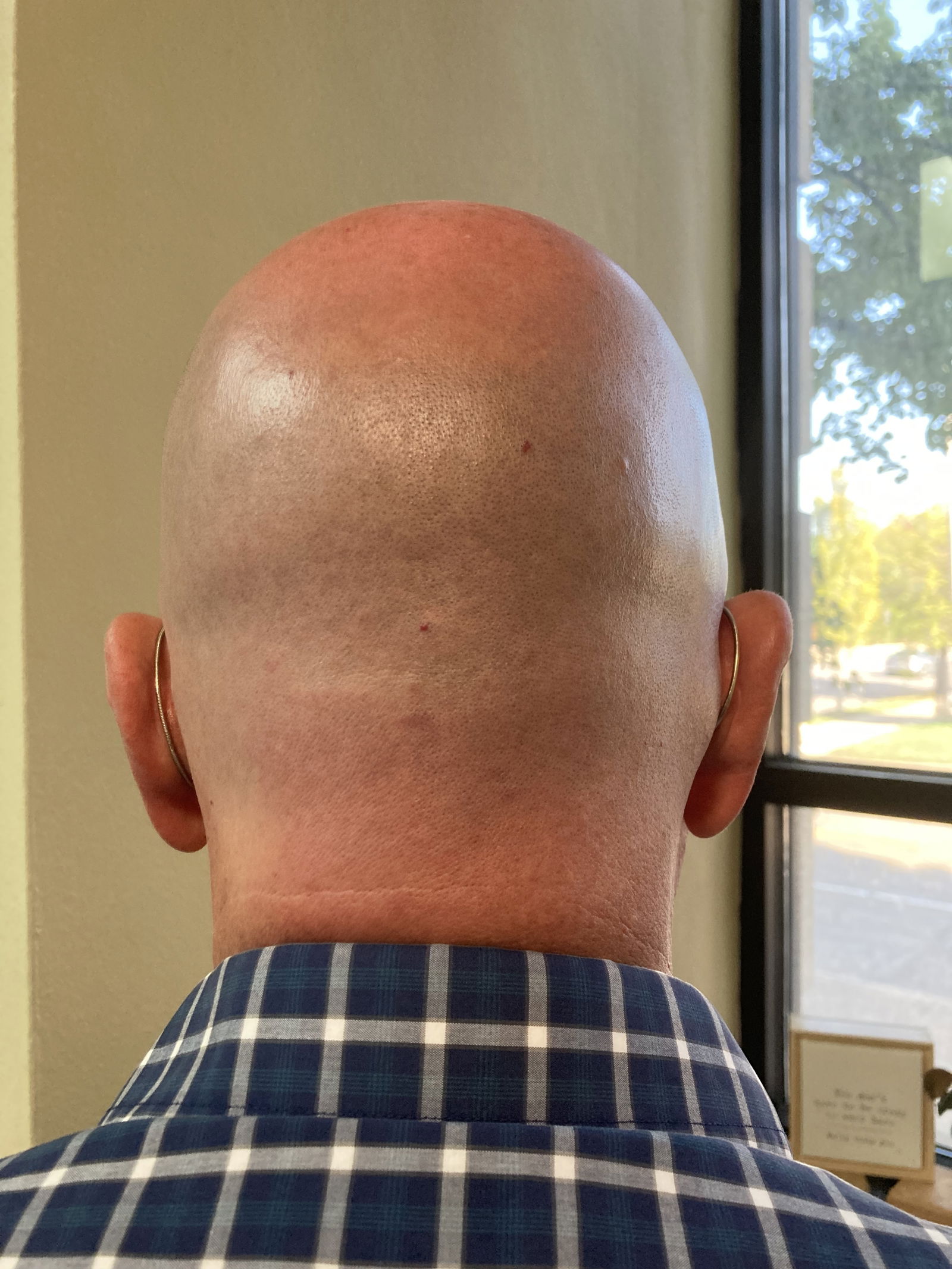 Baldguy's avatar