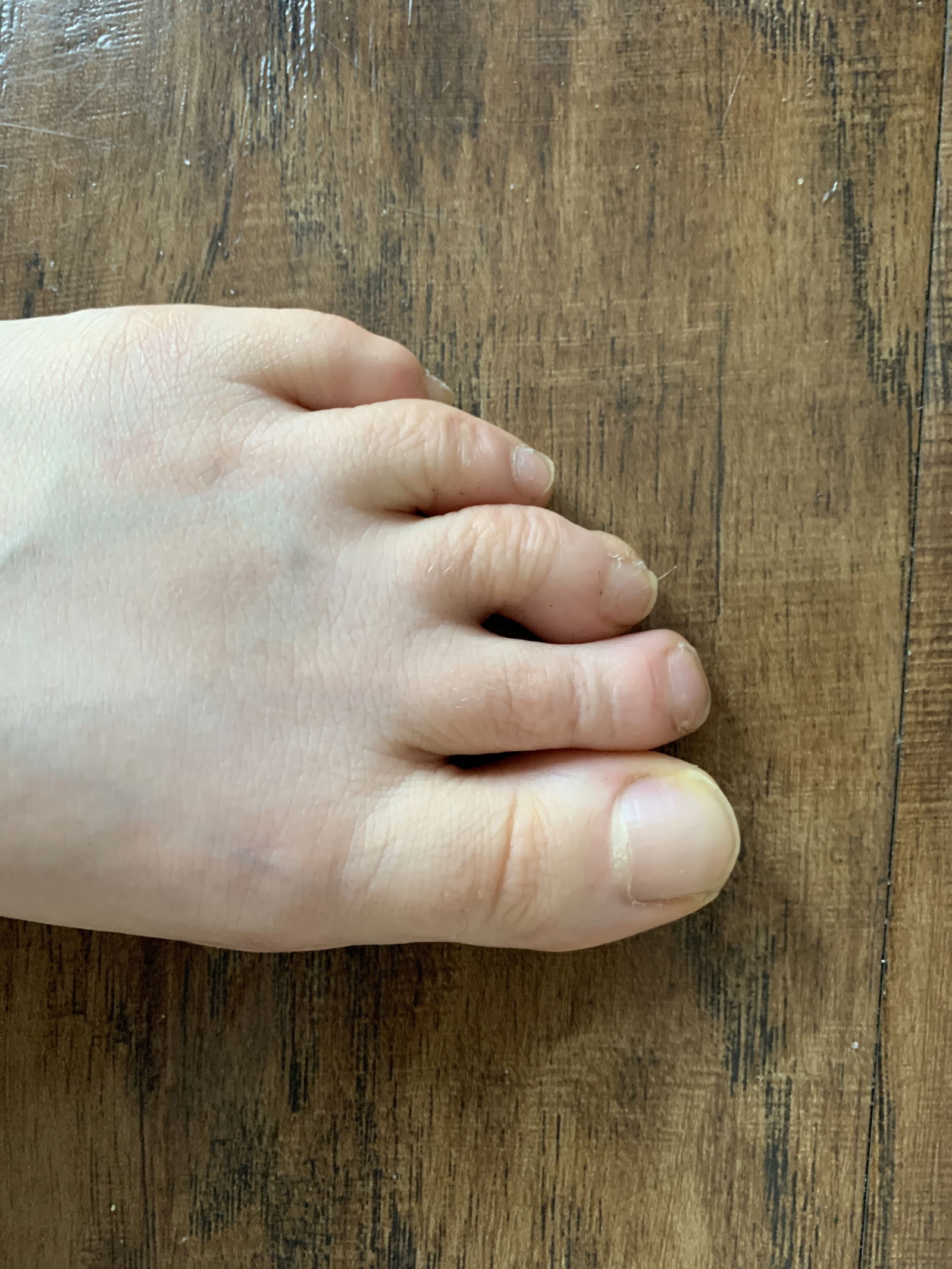 Kiss My Little Feet