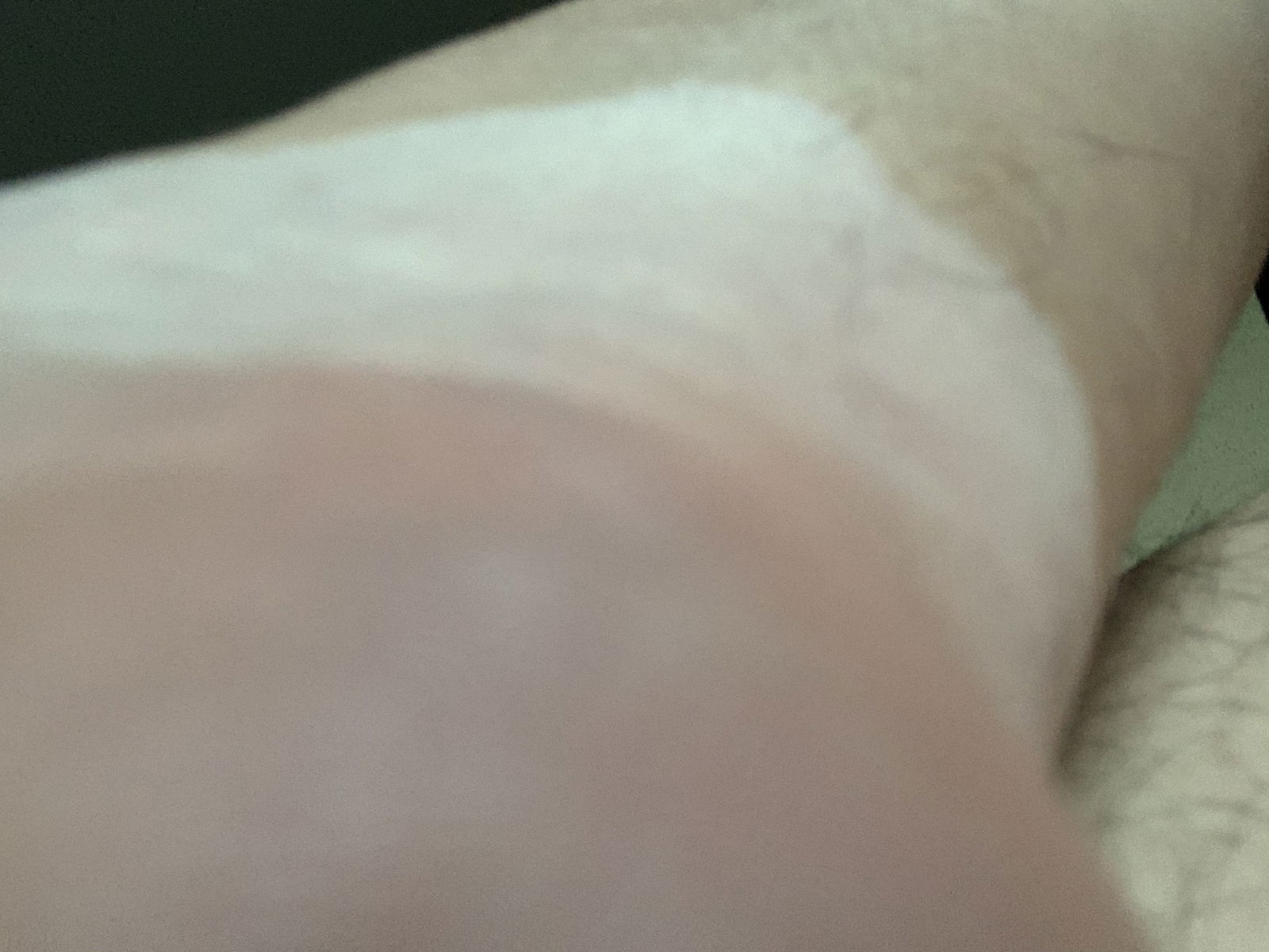 Vitiligo Body Exposed's avatar