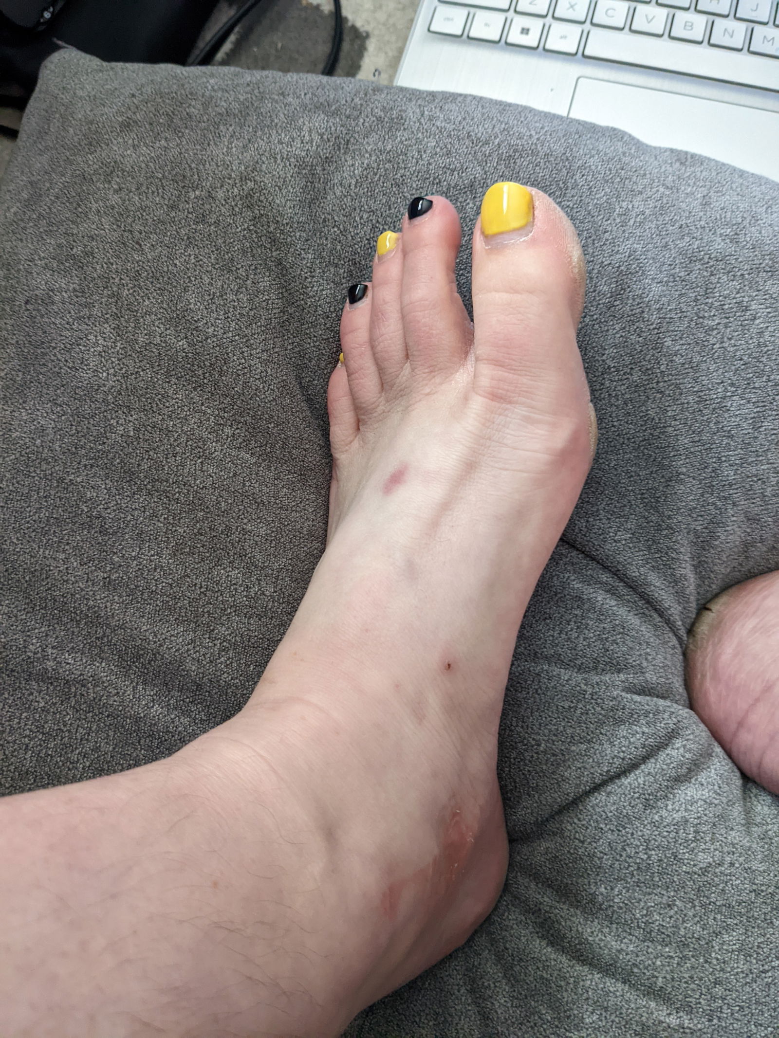 WhiteFeet