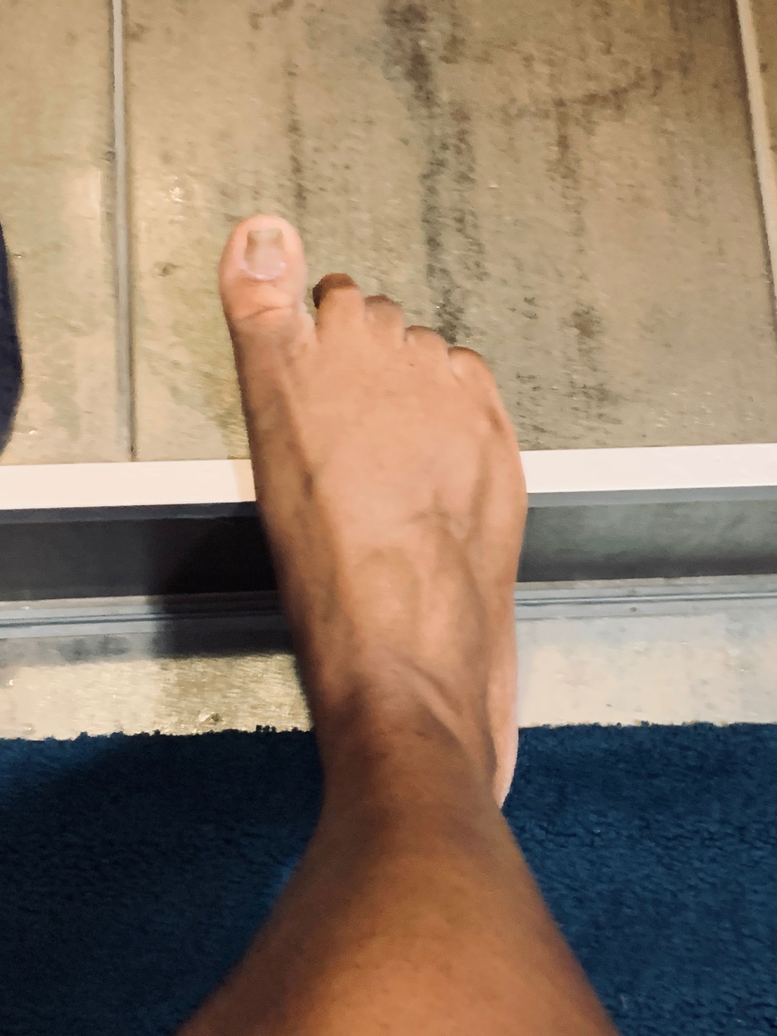 Rough Feet