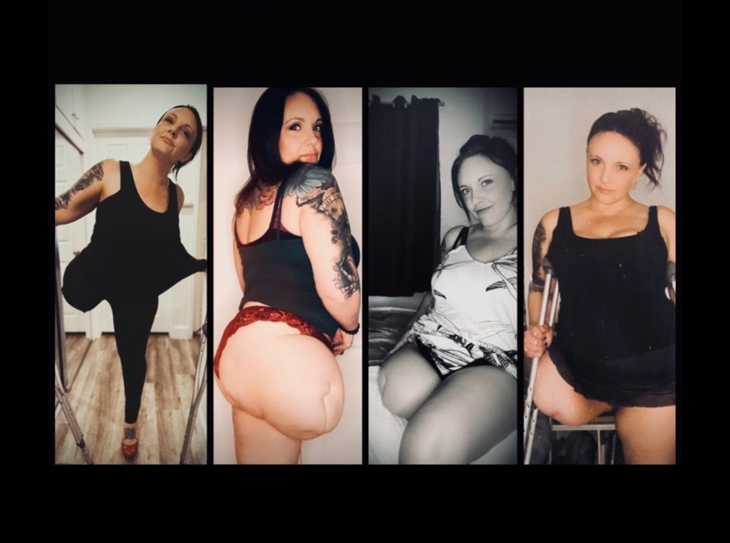 AAmputee Darling profile banner