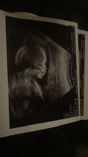 Baby girl ππππ profile banner