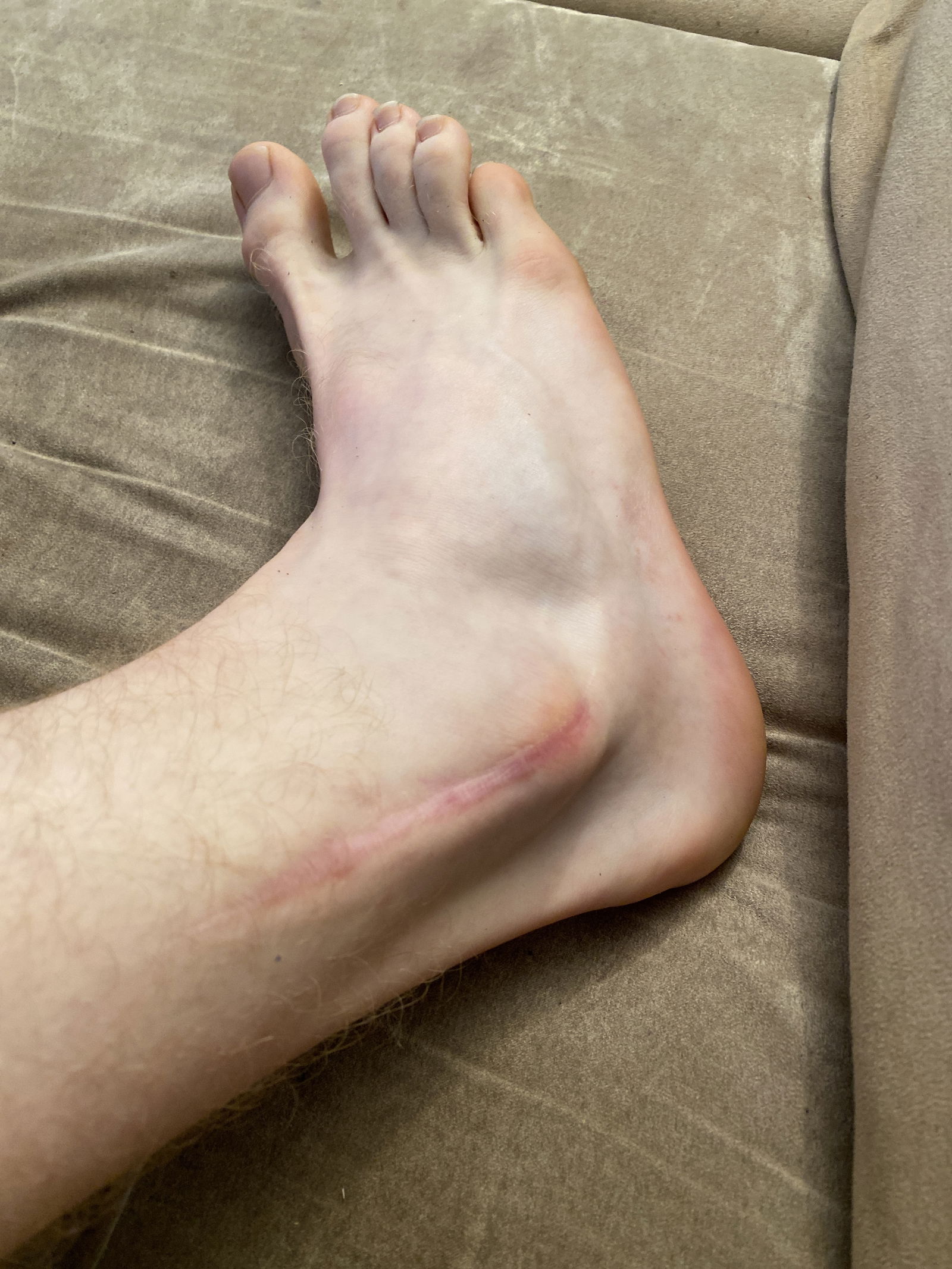FeetWithScares profile banner
