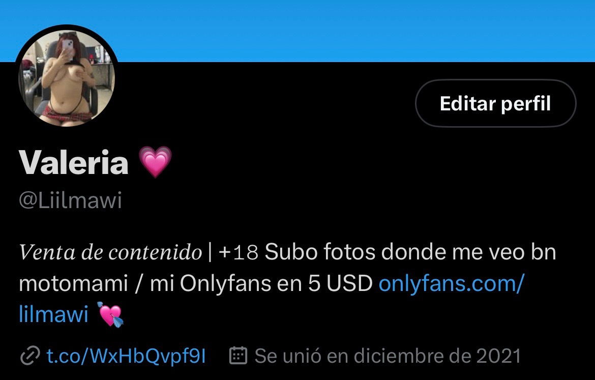 Zero profile banner