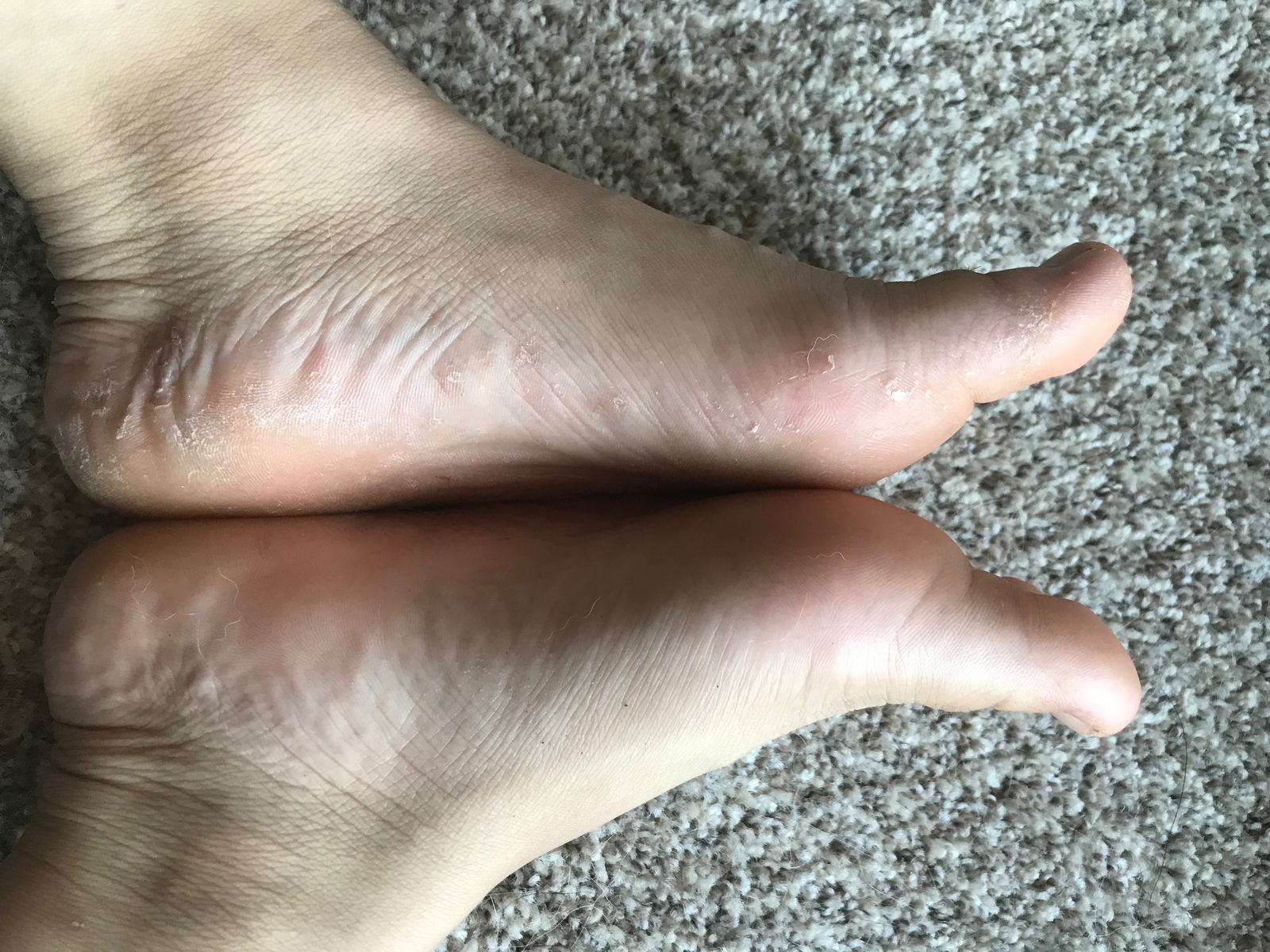 Scaly feet profile banner