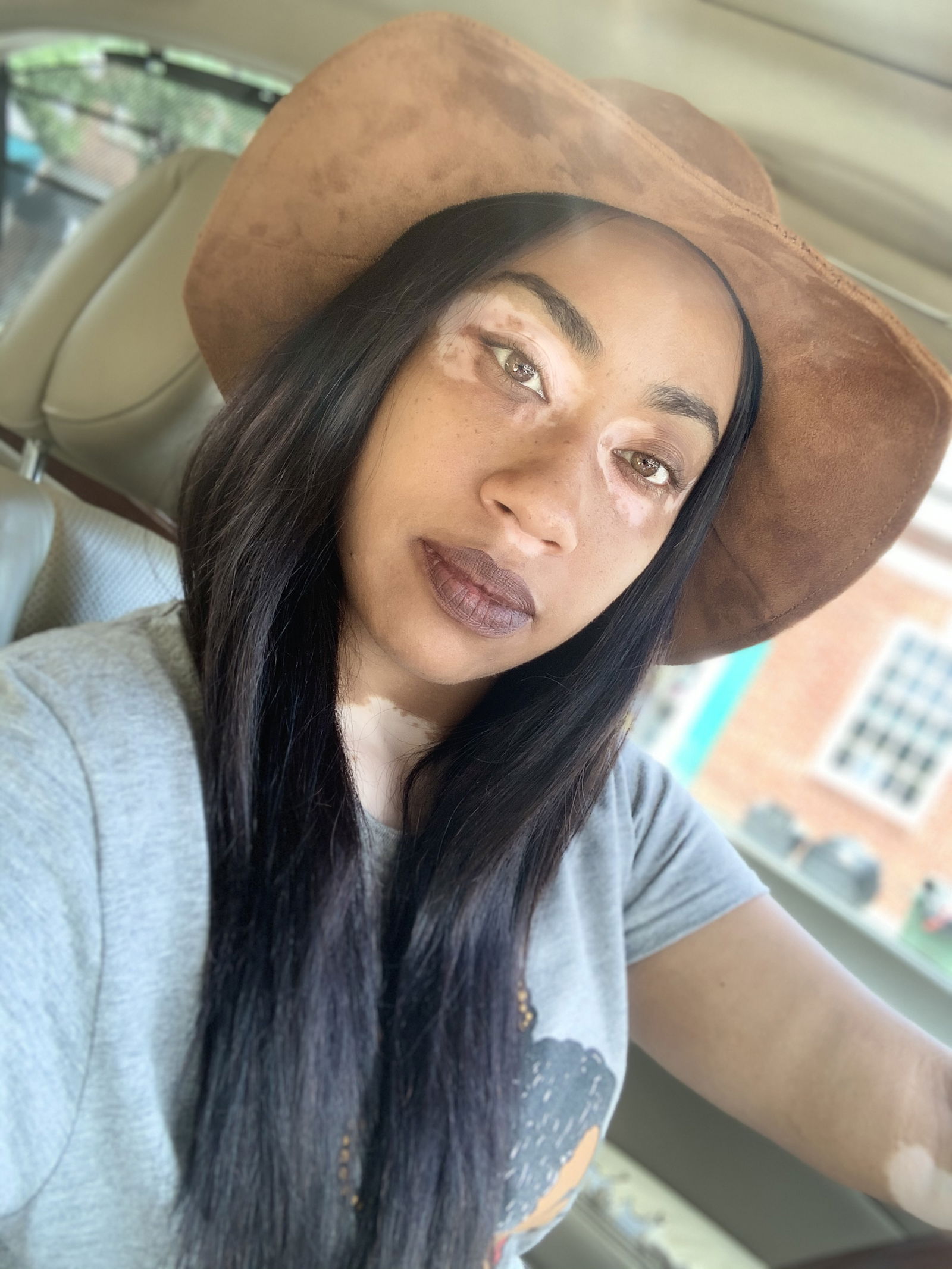 Vitiligo Fox profile banner