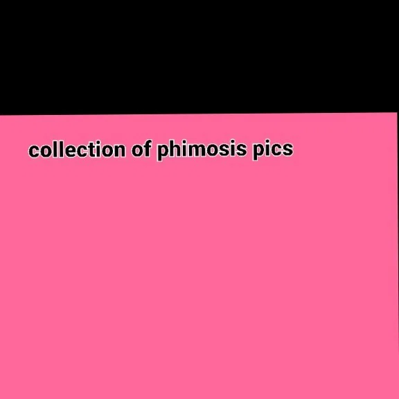 元祖包茎画像集 collection of Phimosis pics profile banner