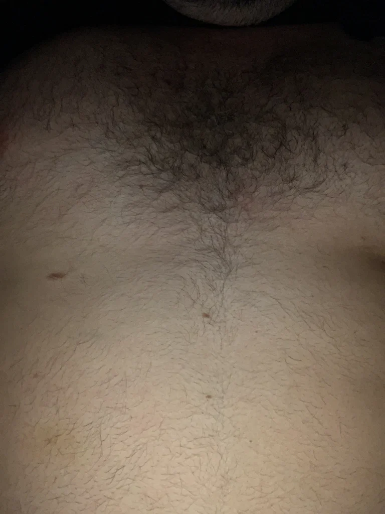 Vers bear