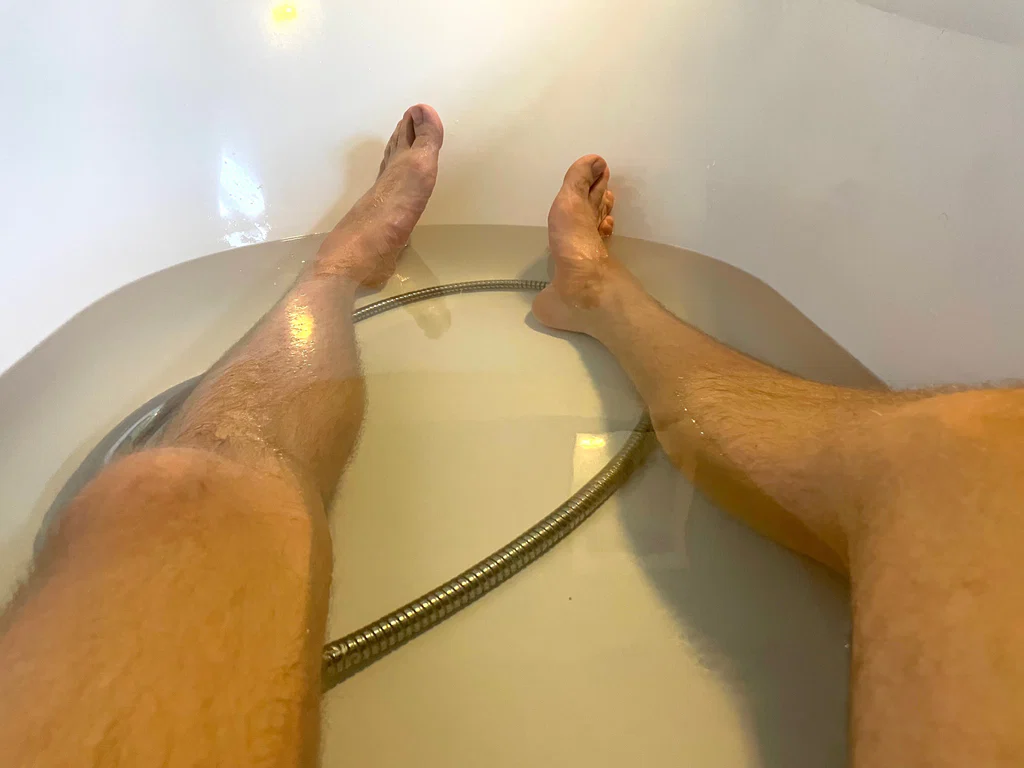 Flat feet and claves