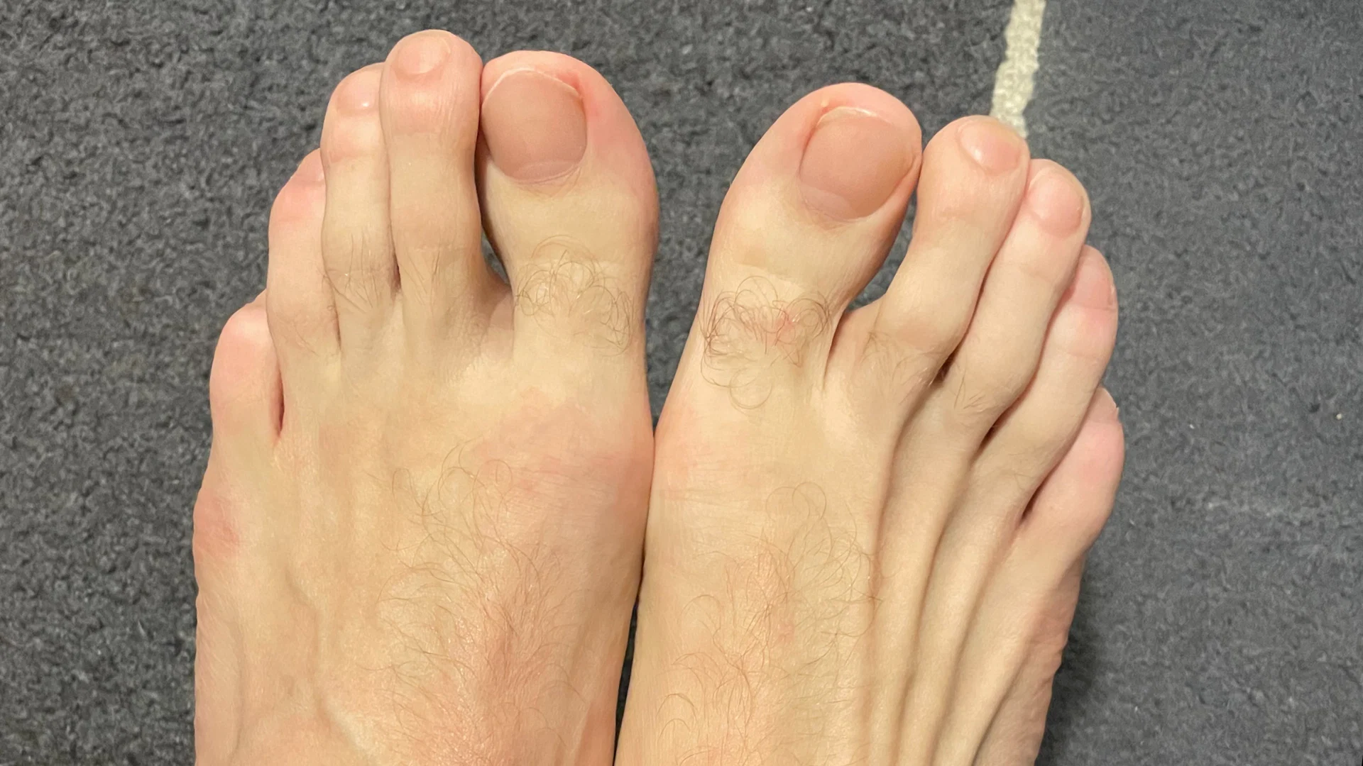 Flat feet and claves profile banner