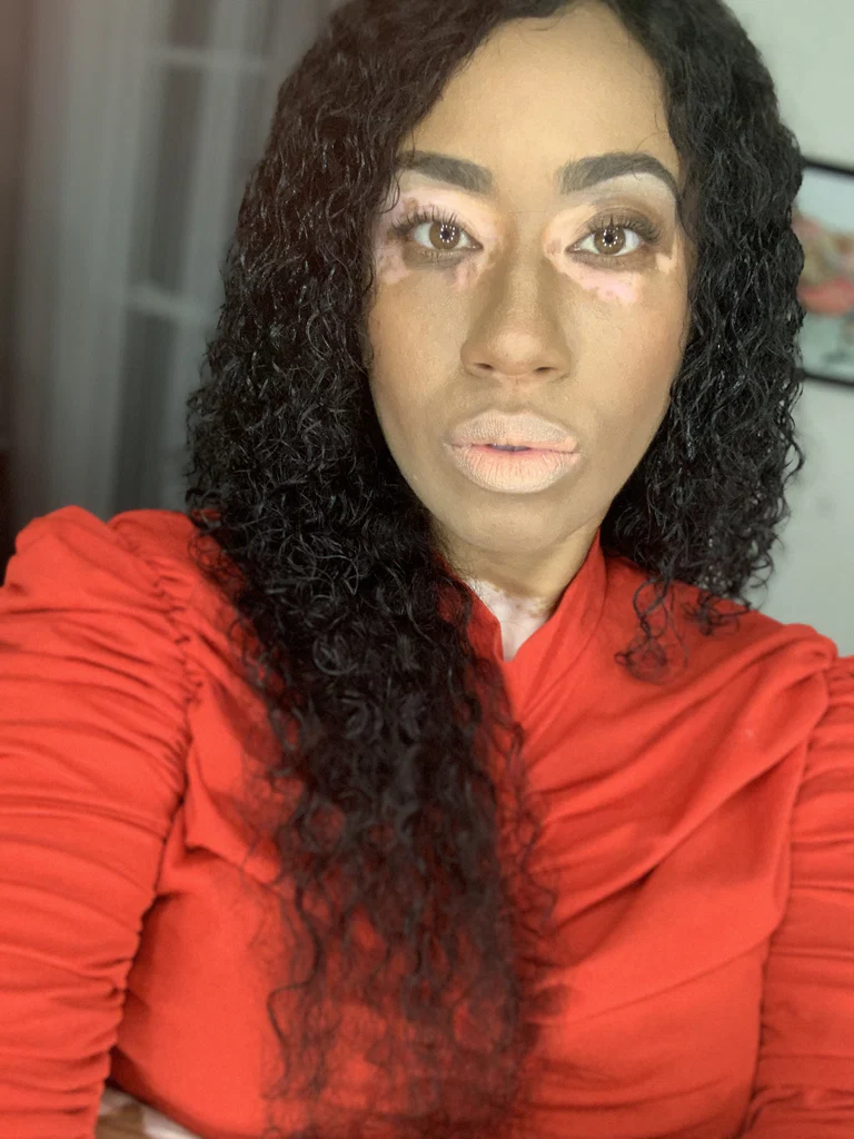 Vitiligo Fox's avatar