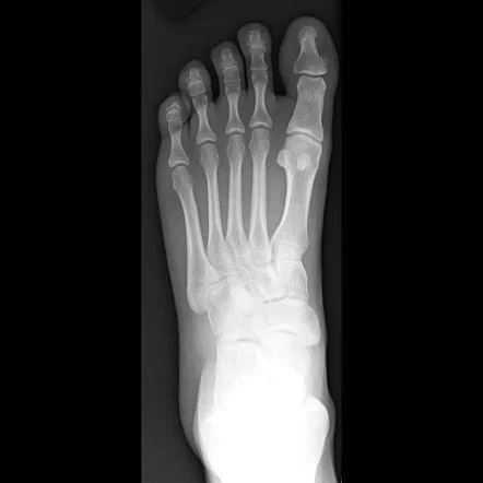 Twinkiest of Toes's avatar