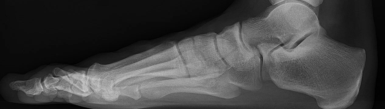 Twinkiest of Toes profile banner