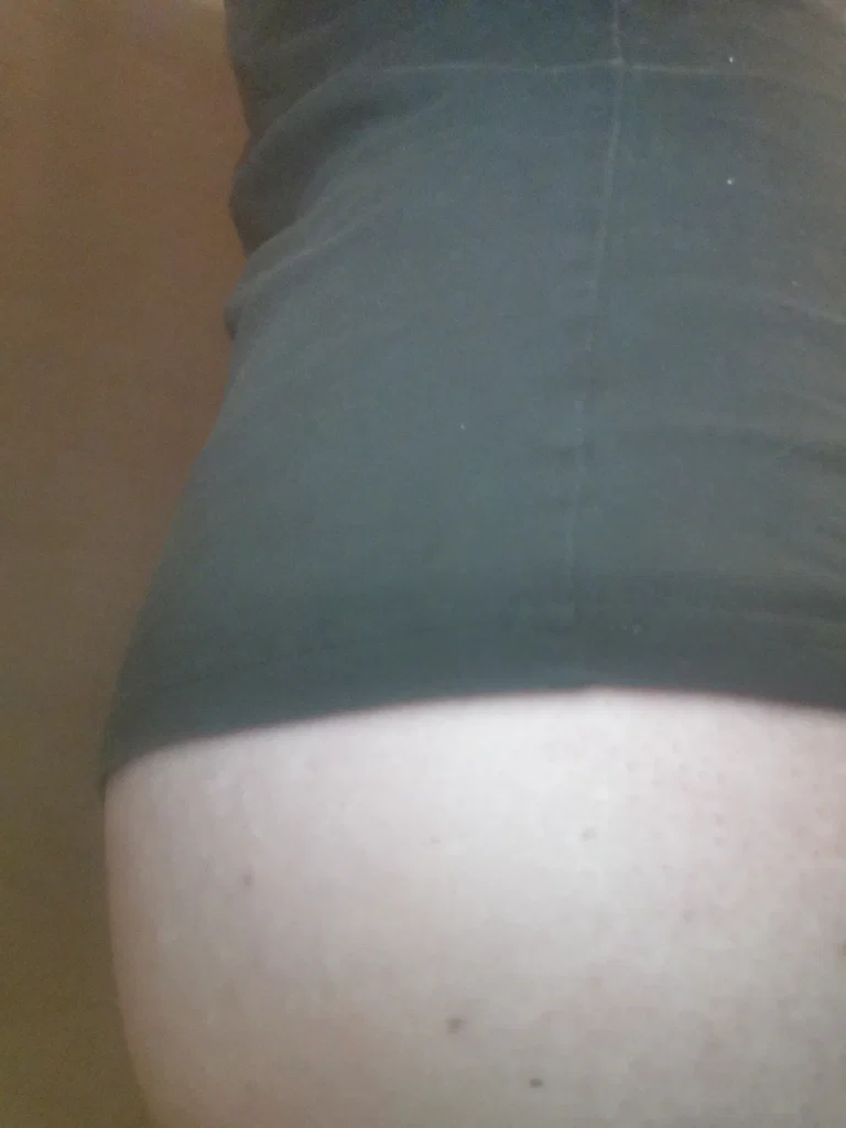 u178326644