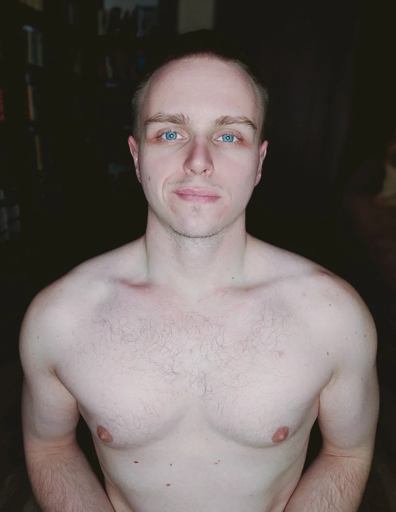 Billy Skarsgaard