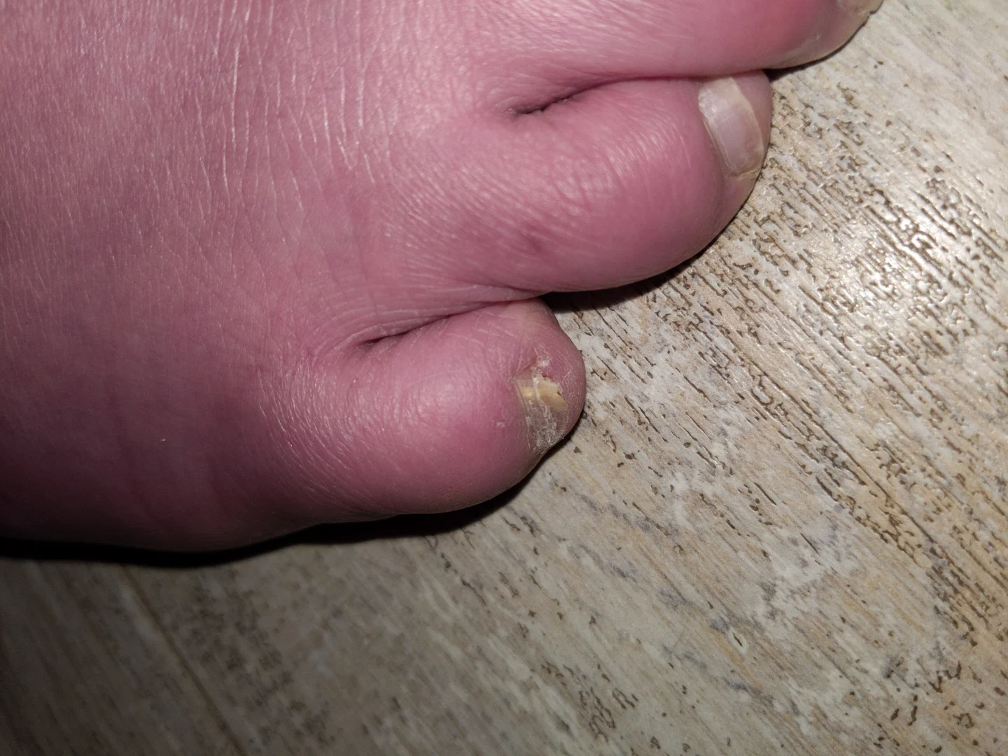 Size 12 feet power bottom, feet pics her profile banner