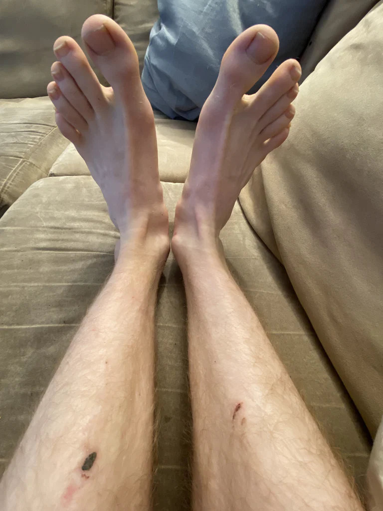 FeetWithScares's avatar