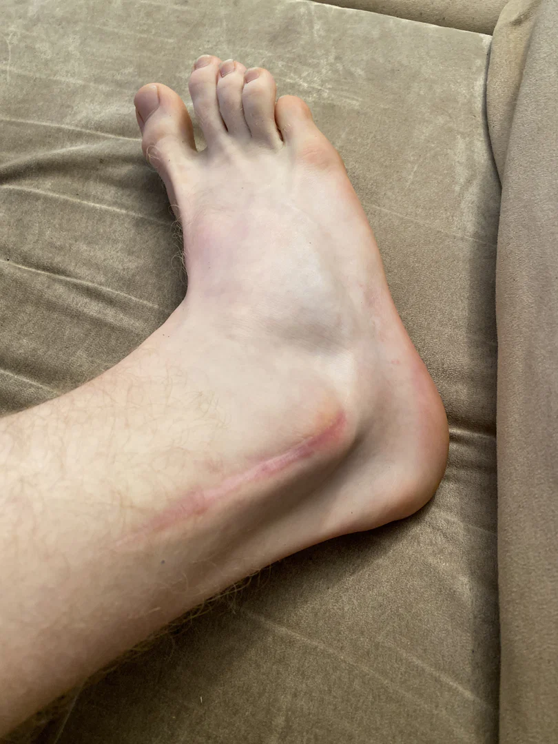 FeetWithScares profile banner