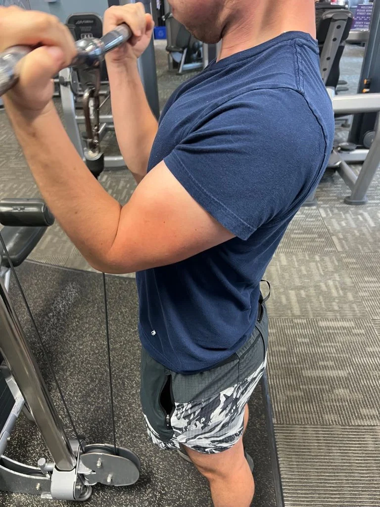 Vitiligoboy