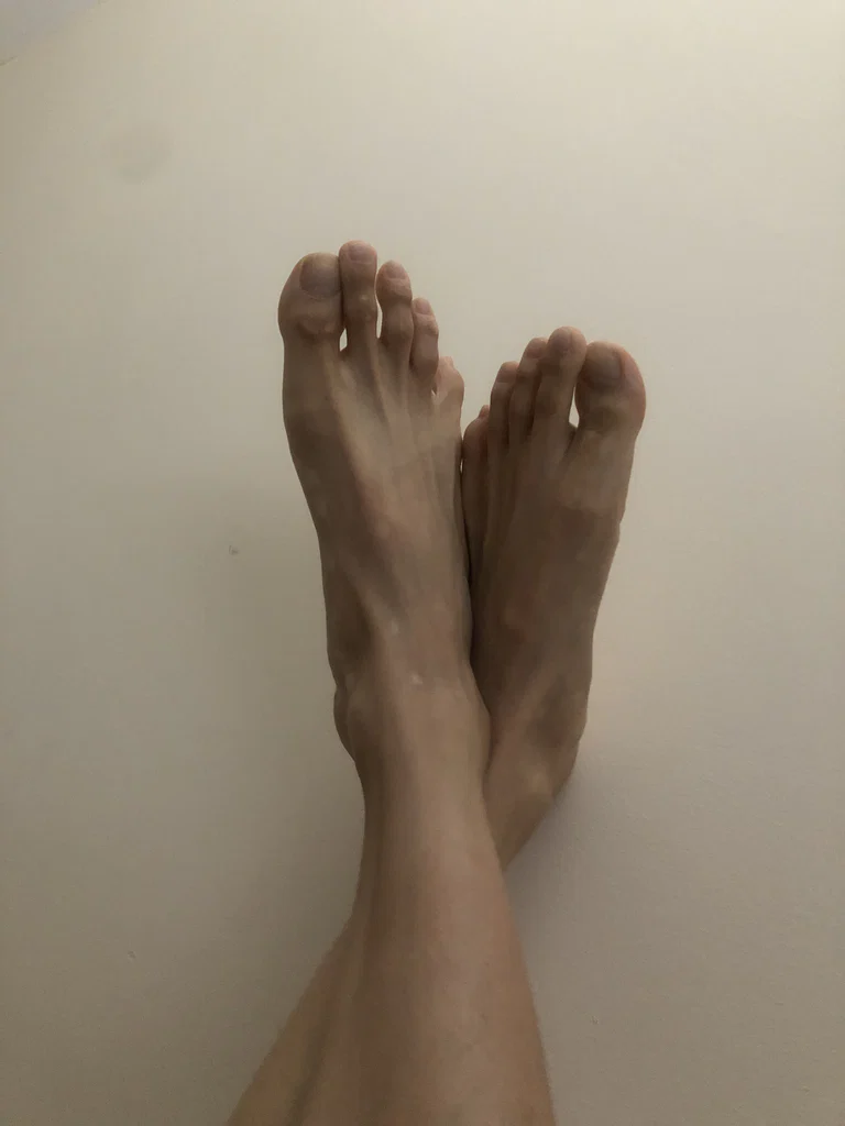 Ugly feet