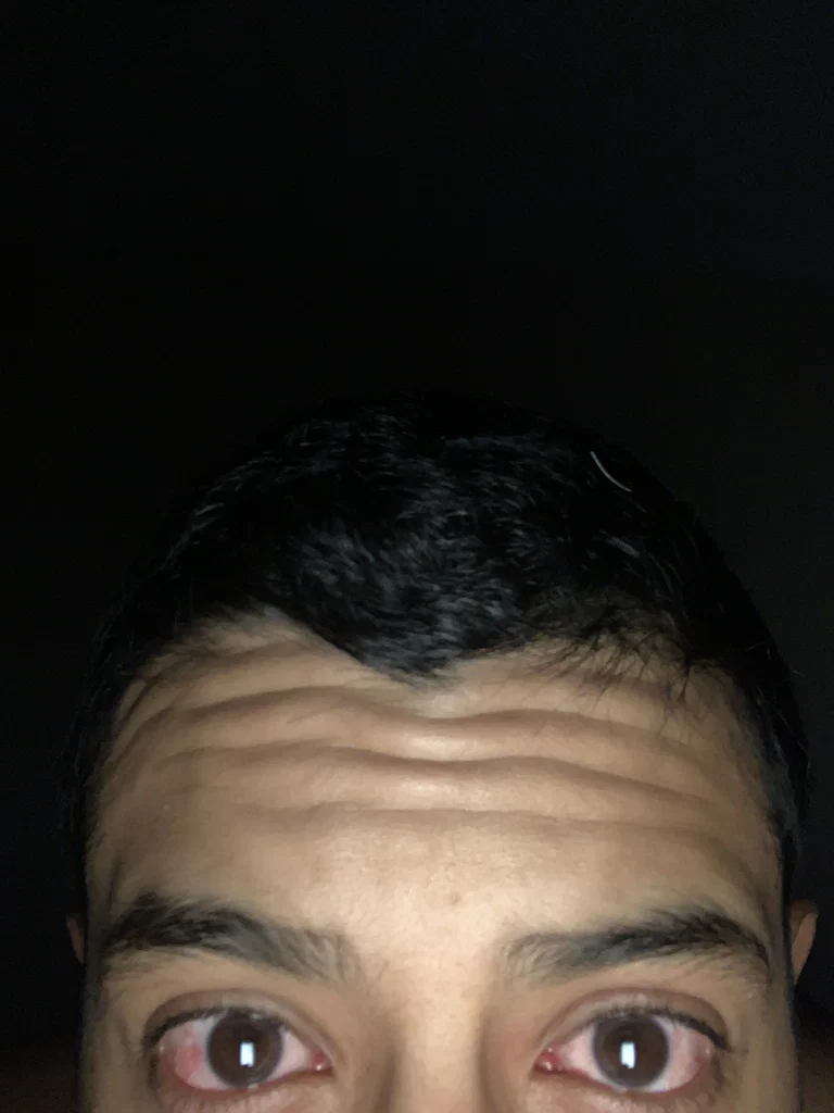 Sirnips