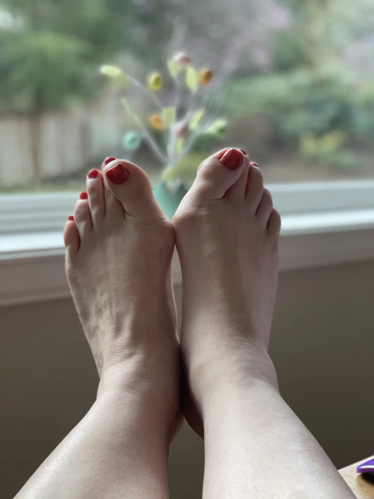 Marissa Bunions