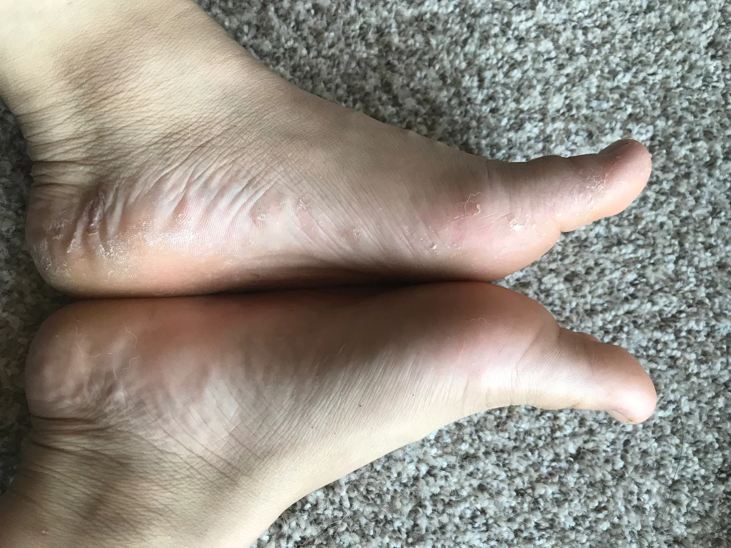 Scaly feet profile banner