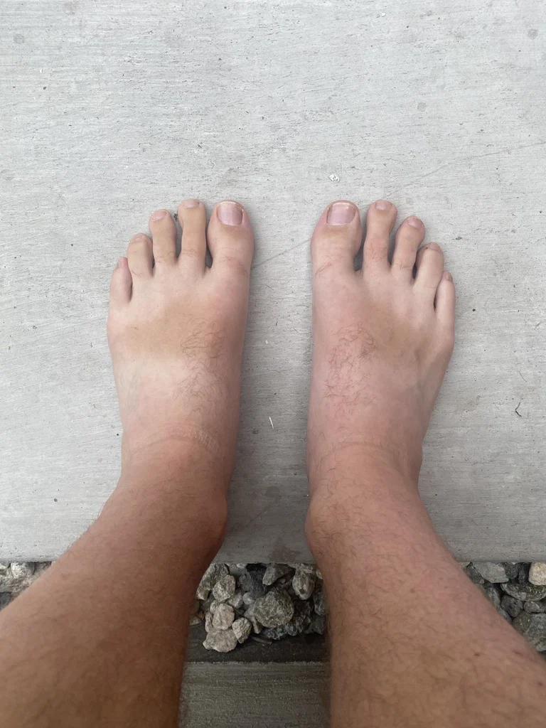Guy with feet and toes