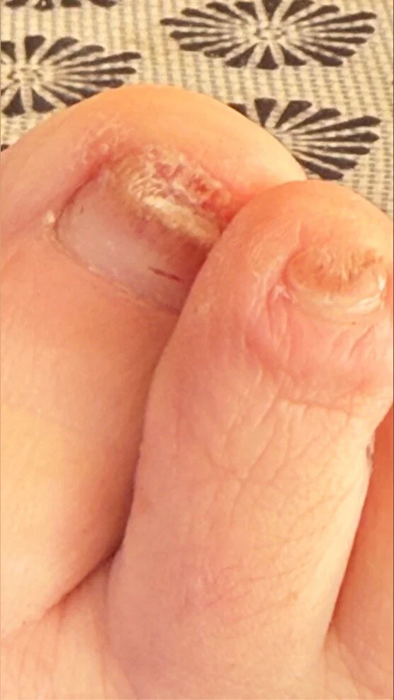 GrossFeetGoddess