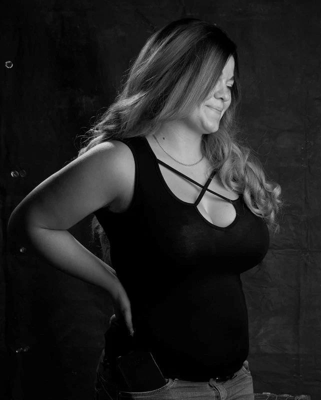 ThickVitiligoSugarBaby