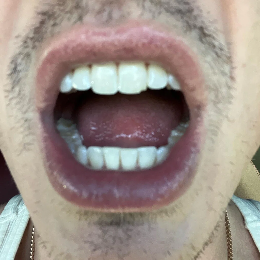 Hoover Mouth GDL's avatar