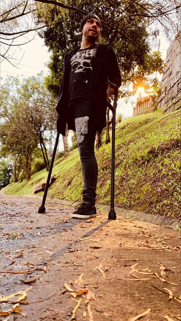 Davidaam Amputee Guy