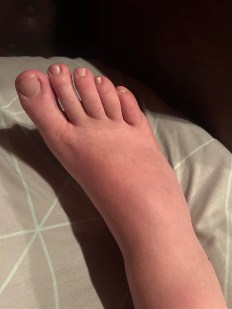 Feet