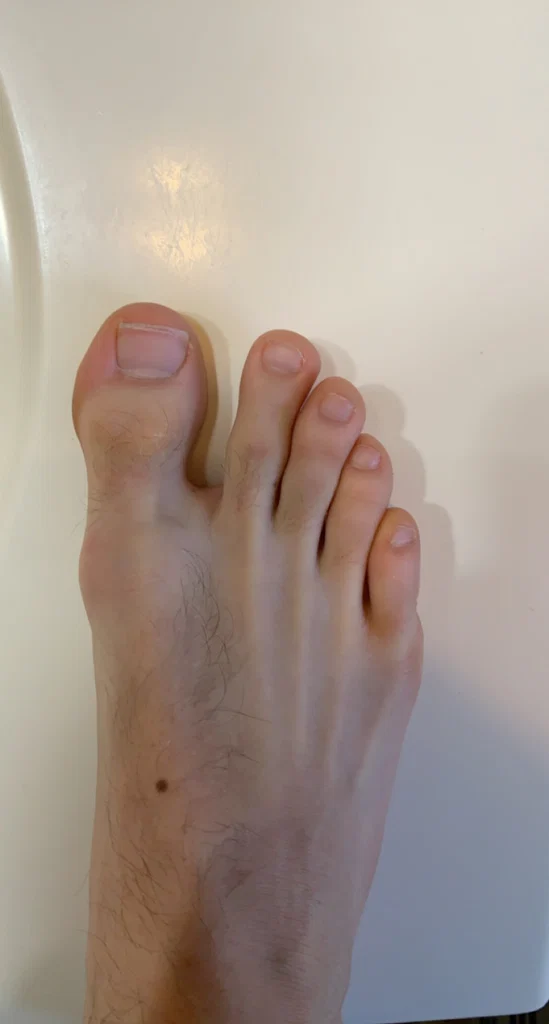 Sirhairyfeet's avatar