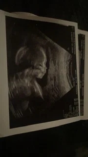 Baby girl ππππ profile banner