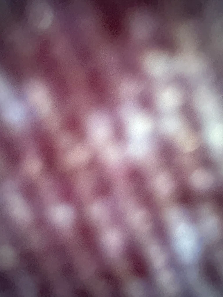 🩷