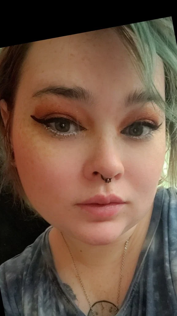 Freckles